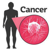 A symbol showing 'cancer'. A figure with a cancer cell highlighted.